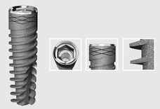 Kooninen Implantti I5