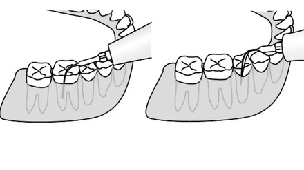 Kavo Piezo Scaler kärki no 203 fine paro