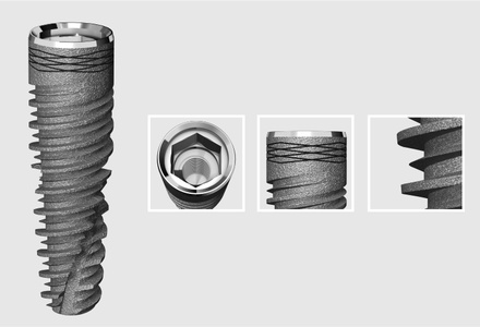 Kooninen Implantti I55