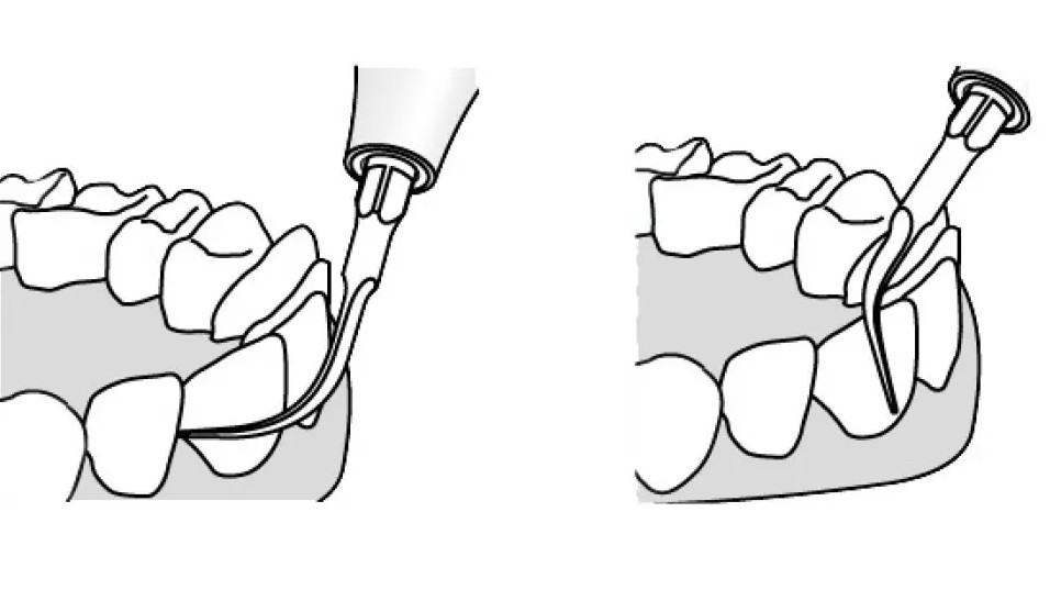 Kavo Piezo Scaler kärki no 202