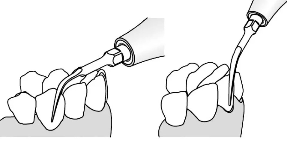 Kavo Piezo Scaler kärki no 201 Universal