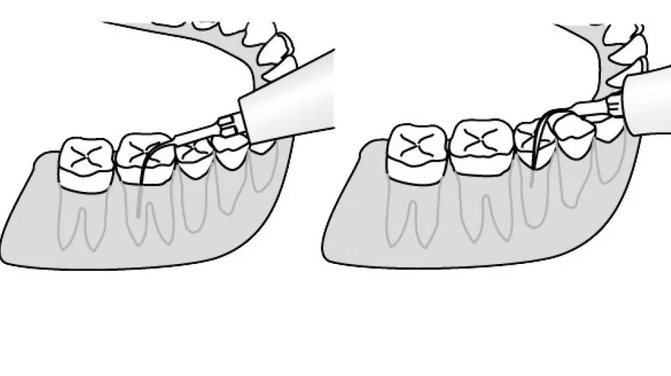 Kavo Piezo Scaler kärki no 203 fine paro